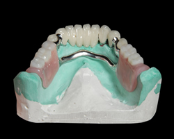 Dentindent - Hareketli Protezler